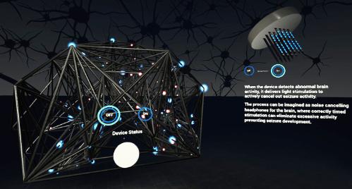 Modifying neuronal activity