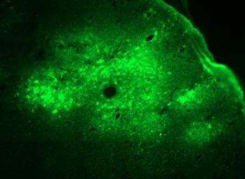 Brain slice with neuronal cells expressing fluorescent marker